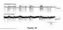 Fig. 11 - Transparent, flexible, low-noise electrodes for simultaneous electrophysiology and neuro-imaging