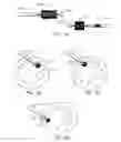 Fig. 03 - ENDOBRONCHIAL BRUSH DEVICE TO ESTIMATE SIZE OF AIRWAYS