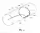 Fig. 06 - ENDOLUMINAL SIZING DEVICE