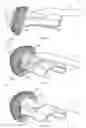 Fig. 31 - Prostate glove, fingertip optical encoder, connector system, and related methods