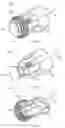 Fig. 32 - Prostate glove, fingertip optical encoder, connector system, and related methods