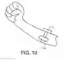 Fig. 12 - System and method for detecting muscle activities