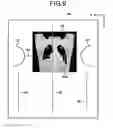 Fig. 09 - X-ray CT apparatus