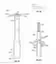 Fig. 09 - Wound closure apparatus and method