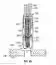 Fig. 11 - Wound closure apparatus and method