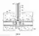 Fig. 12 - Wound closure apparatus and method