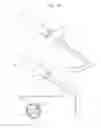 Fig. 14 - Medical retractor