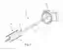 Fig. 04 - LATERAL ACCESS SYSTEM FOR THE LUMBAR SPINE