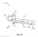 Fig. 27 - LATERAL ACCESS SYSTEM FOR THE LUMBAR SPINE