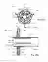 Fig. 30 - LATERAL ACCESS SYSTEM FOR THE LUMBAR SPINE