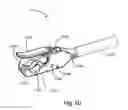 Fig. 50 - LATERAL ACCESS SYSTEM FOR THE LUMBAR SPINE