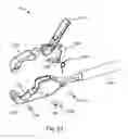 Fig. 53 - LATERAL ACCESS SYSTEM FOR THE LUMBAR SPINE