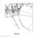 Fig. 62 - LATERAL ACCESS SYSTEM FOR THE LUMBAR SPINE