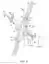 Fig. 09 - Surgical access system and related methods