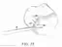 Fig. 19 - Surgical access system and related methods