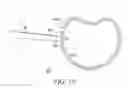 Fig. 20 - Surgical access system and related methods