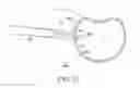 Fig. 24 - Surgical access system and related methods