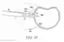 Fig. 26 - Surgical access system and related methods