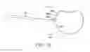 Fig. 27 - Surgical access system and related methods