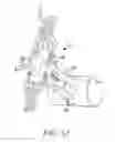 Fig. 33 - Surgical access system and related methods