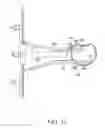 Fig. 34 - Surgical access system and related methods