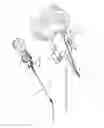 Fig. 07 - Knotless suture anchor and deployment device