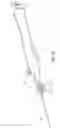 Fig. 13 - T-fastener suture delivery system