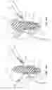 Fig. 15 - T-fastener suture delivery system