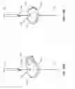 Fig. 17 - T-fastener suture delivery system