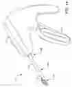 Fig. 02 - Prosthetic suturing device and methods thereof