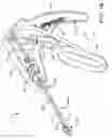 Fig. 03 - Prosthetic suturing device and methods thereof