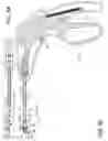 Fig. 09 - Prosthetic suturing device and methods thereof