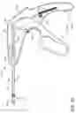 Fig. 16 - Prosthetic suturing device and methods thereof