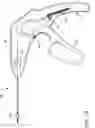 Fig. 19 - Prosthetic suturing device and methods thereof