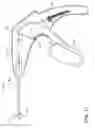 Fig. 20 - Prosthetic suturing device and methods thereof