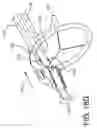 Fig. 24 - Prosthetic suturing device and methods thereof
