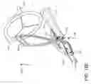 Fig. 25 - Prosthetic suturing device and methods thereof