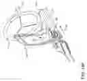 Fig. 26 - Prosthetic suturing device and methods thereof