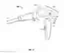 Fig. 17 - Battery powered surgical instrument