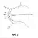 Fig. 06 - SYSTEM, APPARATUS, AND METHOD FOR CREATION AND IMPLANTATION OF TISSUE GRAFTS