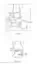 Fig. 03 - Arthroscopic surgery method for ankle impingement