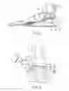 Fig. 05 - Arthroscopic surgery method for ankle impingement