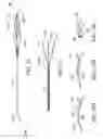 Fig. 34 - Clot retrieval system