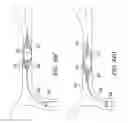 Fig. 48 - Clot retrieval system