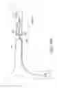 Fig. 61 - Clot retrieval system
