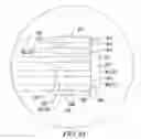 Fig. 83 - Clot retrieval system