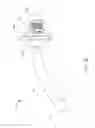 Fig. 11 - Nasal balloon catheter and sponge unit