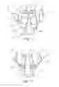 Fig. 02 - Spring-biased nasal molding device