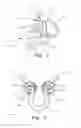 Fig. 03 - Spring-biased nasal molding device