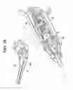 Fig. 17 - Surgical devices with articulating end effectors and methods of using surgical devices with articulating end effectors